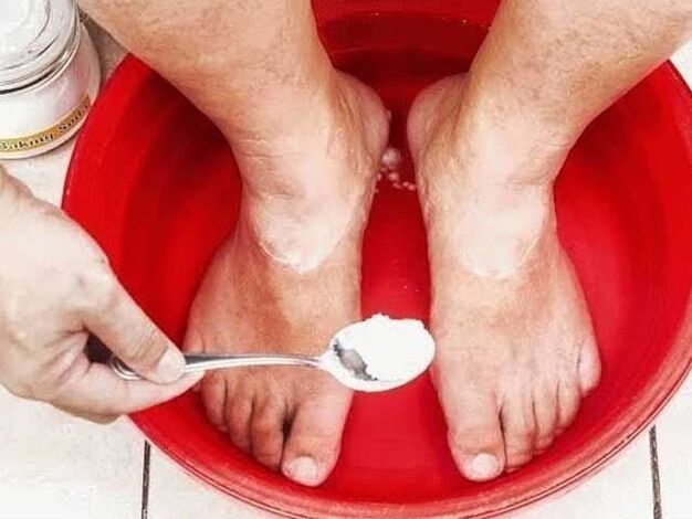 sodos vonios nuo grybelio