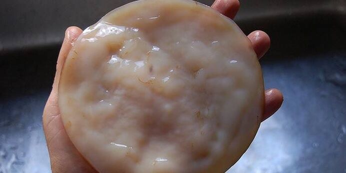 Kombucha nuo nagų grybelio